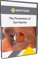 Eye Injuries, The Prevention of